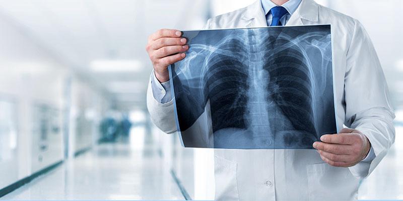 Image of a doctor holding a chest x-ray in a hospital corridor