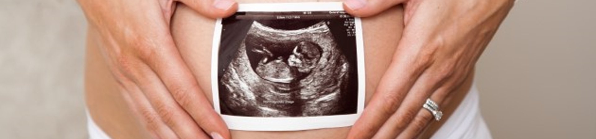 ultrasound picture