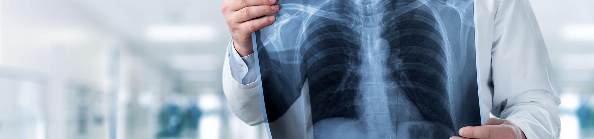 Image of a doctor holding a chest x-ray in a hospital corridor
